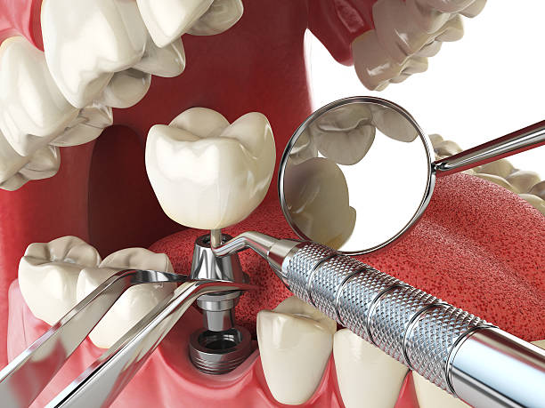 Reliable KS Emergency Dentist Solutions